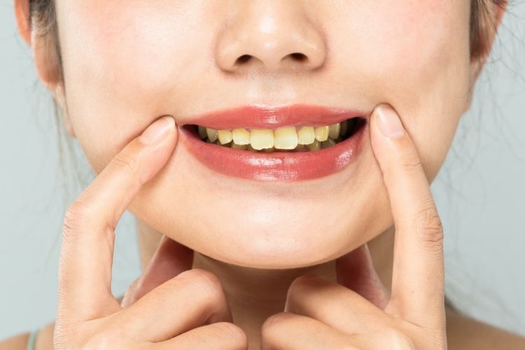 6 hal yang menyebabkan gigi kuning selain makanan. termasuk obat kumur