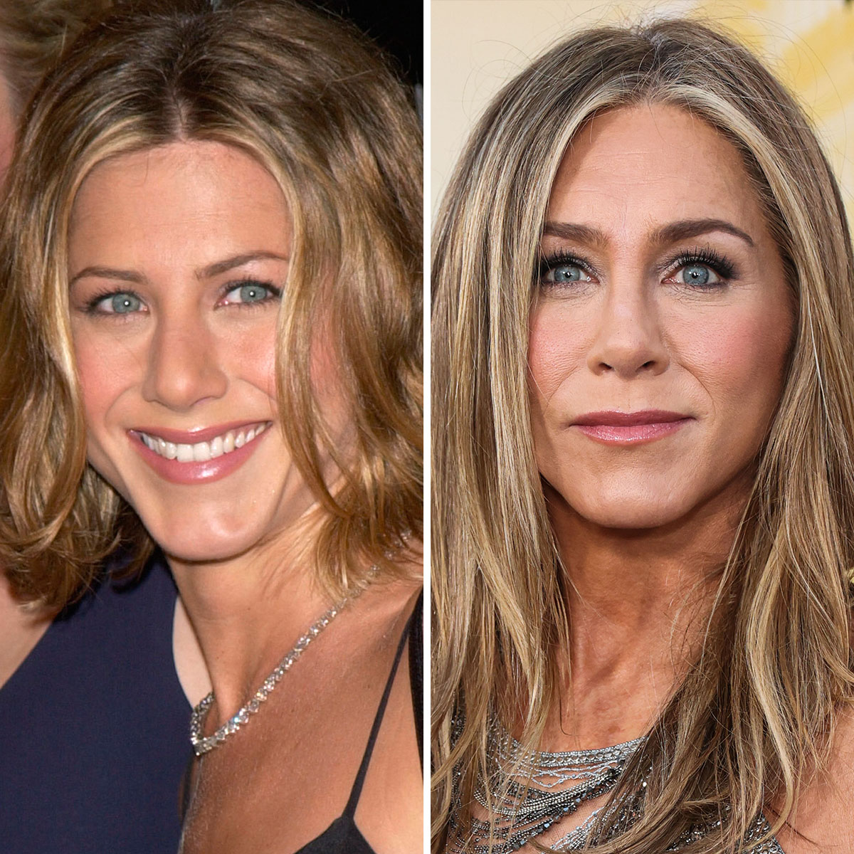 Jennifer Aniston Slammed For Plastic Surgery Amid The Morning Show   AA1iZtDS.img