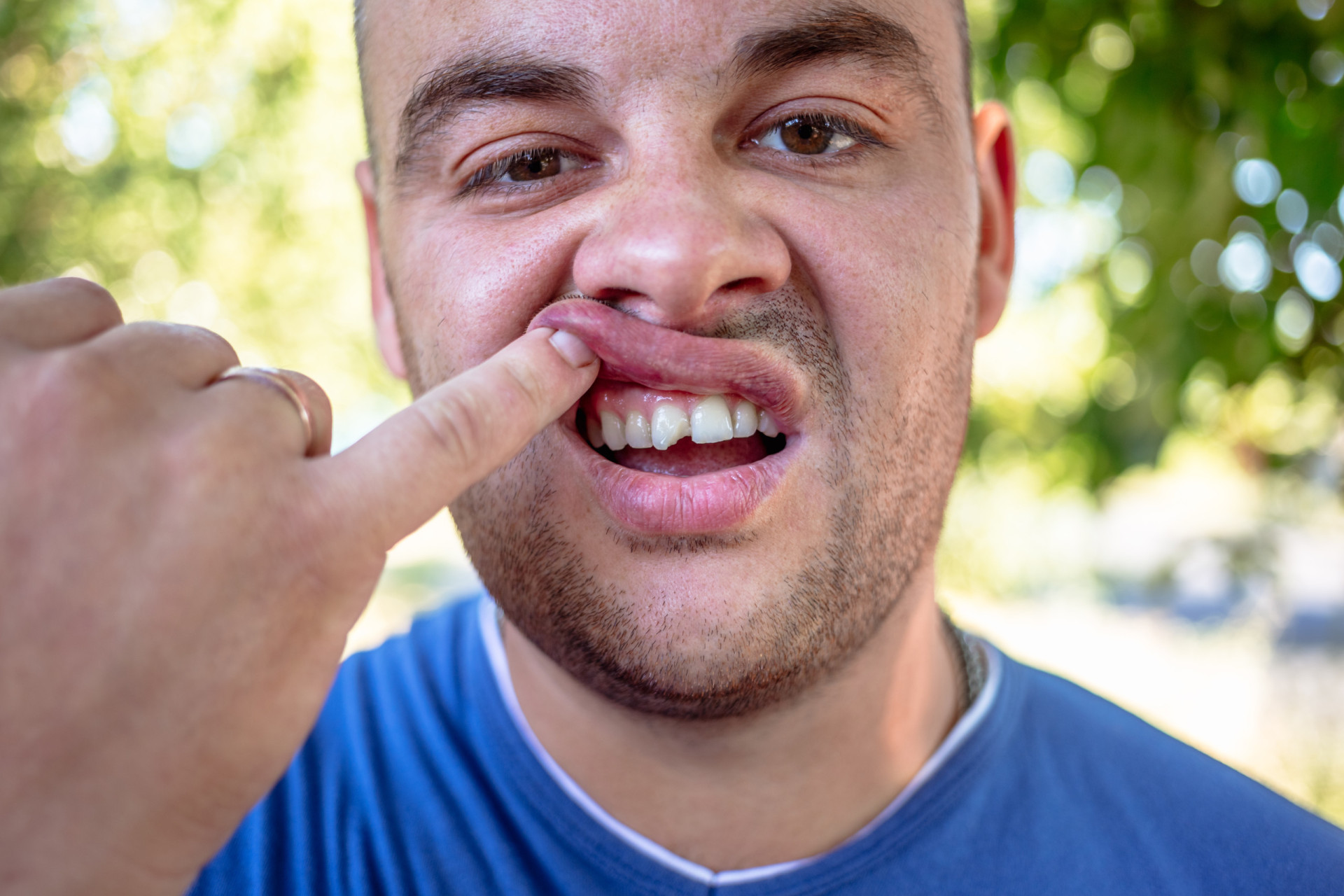 <p>Surely, you can't go to work with a chipped tooth, right? Especially after being assaulted by your loved one!</p><p><a href="https://www.msn.com/en-us/community/channel/vid-7xx8mnucu55yw63we9va2gwr7uihbxwc68fxqp25x6tg4ftibpra?cvid=94631541bc0f4f89bfd59158d696ad7e">Follow us and access great exclusive content every day</a></p>