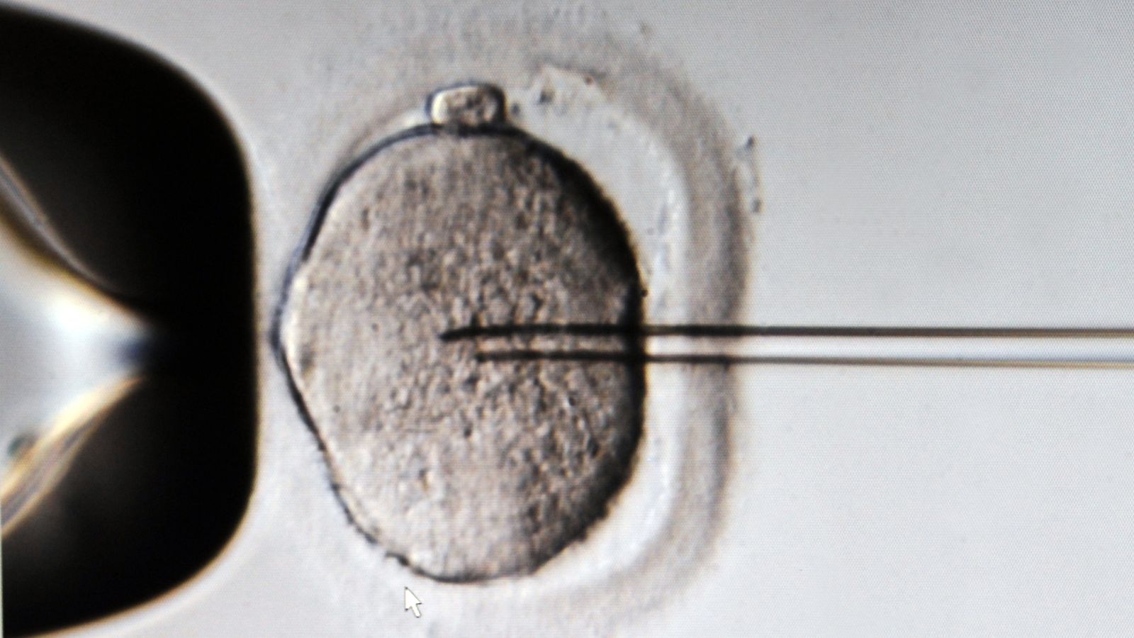 more than 100 fertility patients 'exposed to faulty egg and embryo freezing liquid'