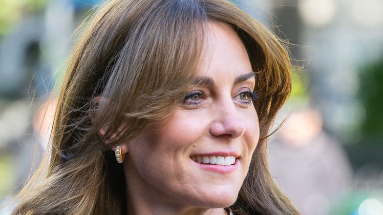 Kate Middleton With Botox? Experts Have No Doubts. Here's Why