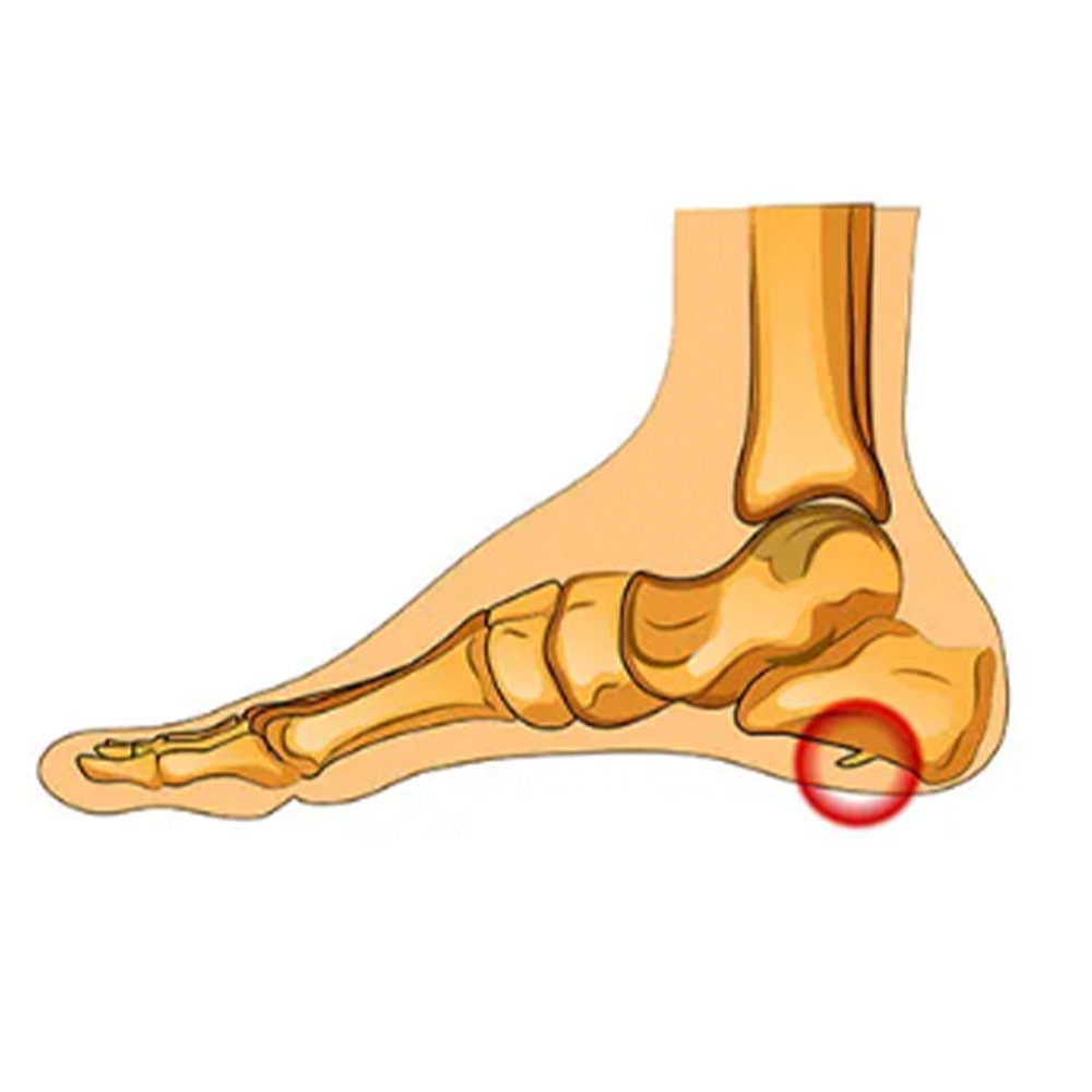 The 15 Most Common Foot Problems and How to Treat Them, According to ...