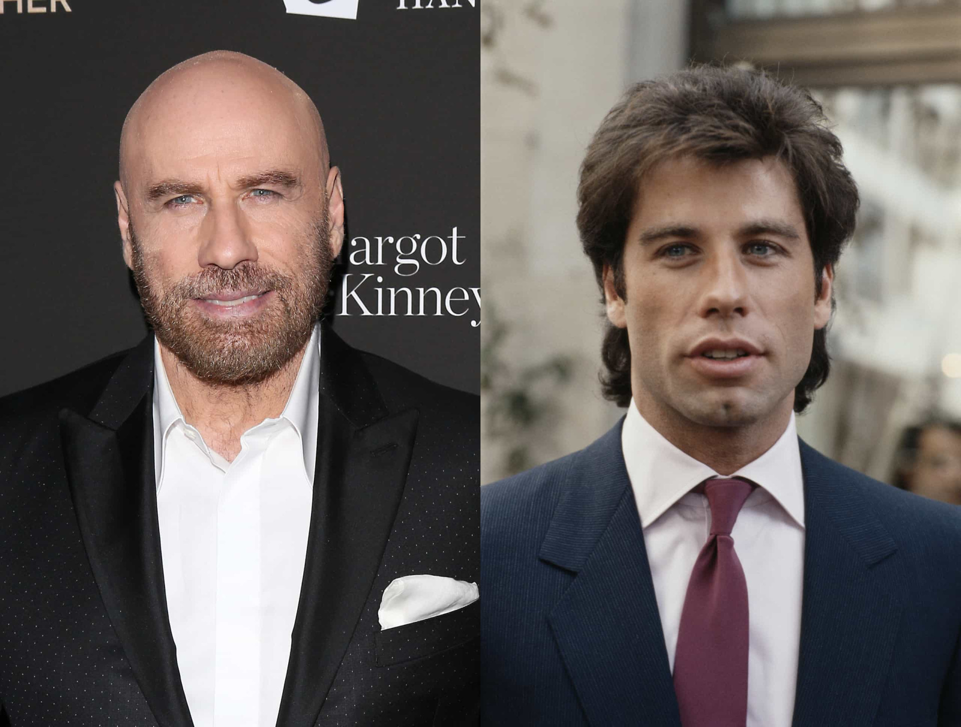 Do you remember when these bald stars still had hair?