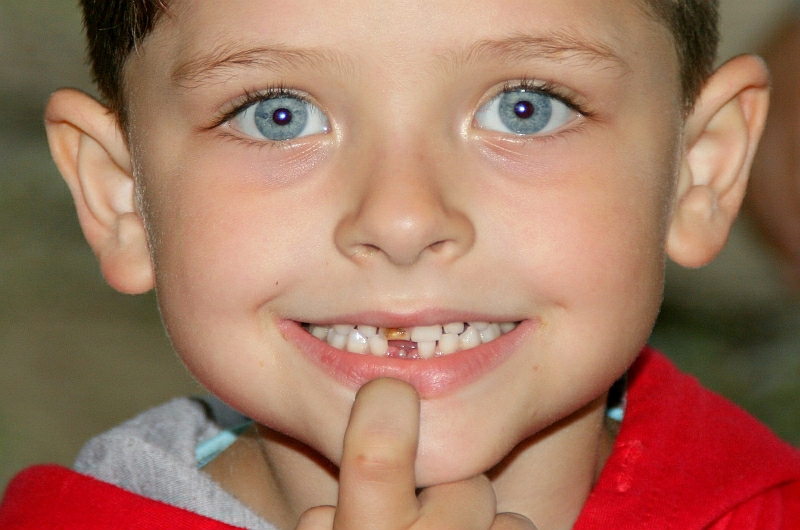 К чему снится зуб раскрошился без крови. К чему снится что зубы крошатся и выпадают без крови. У ребенка 5 лет раскрошился зуб фото. К чему снится зубы крошатся во рту у себя. Дети с выпавшими зубами милые фото.