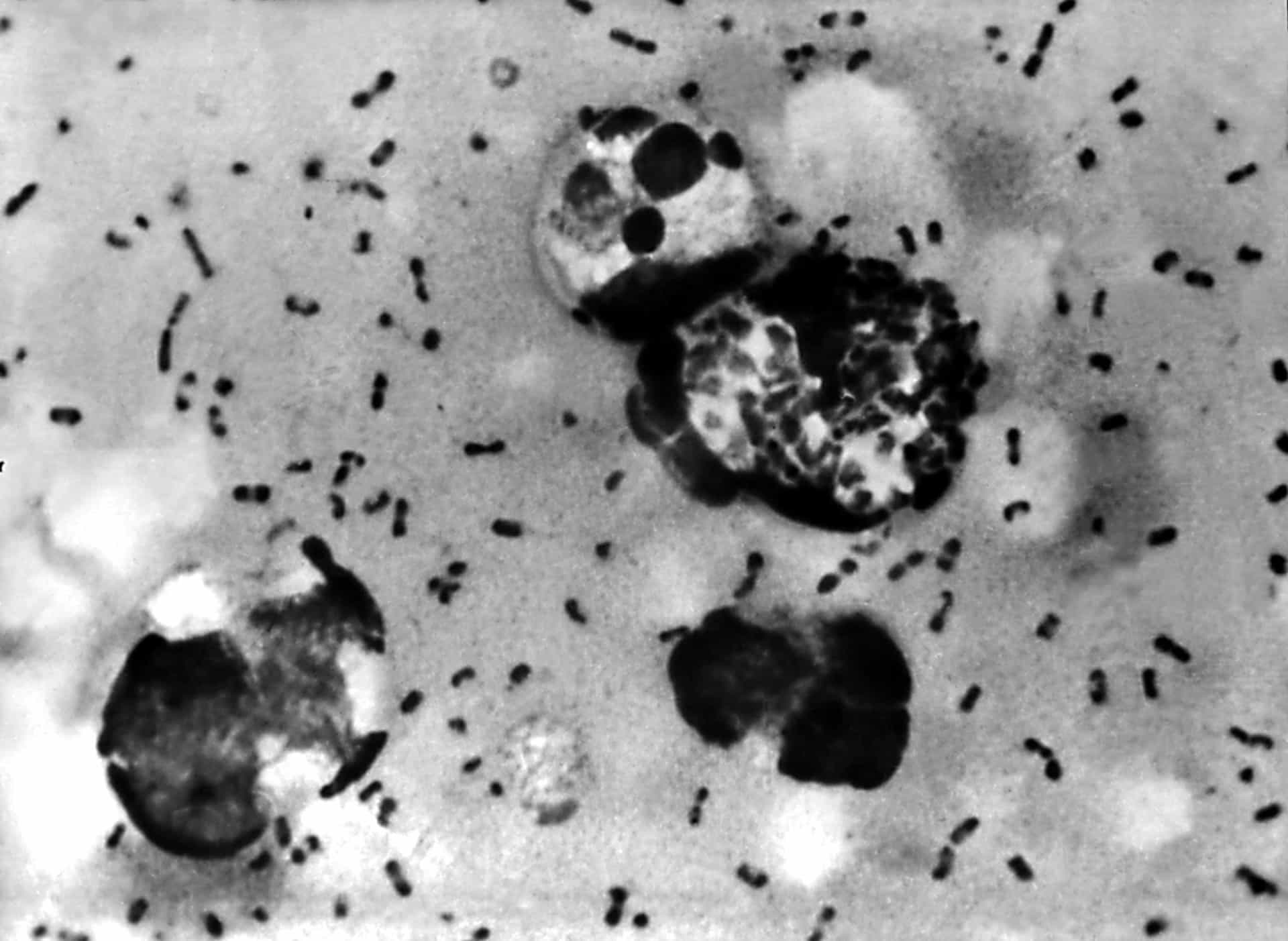 <p>The Black Death was the deadliest pandemic ever recorded. It signaled the start of the Second Pandemic, a chain of tragic outbreaks that occurred from the 1300s to the early 1800s. Yersinia pestis or Y. pestis, a bacterium, was responsible for this bubonic plague.</p>