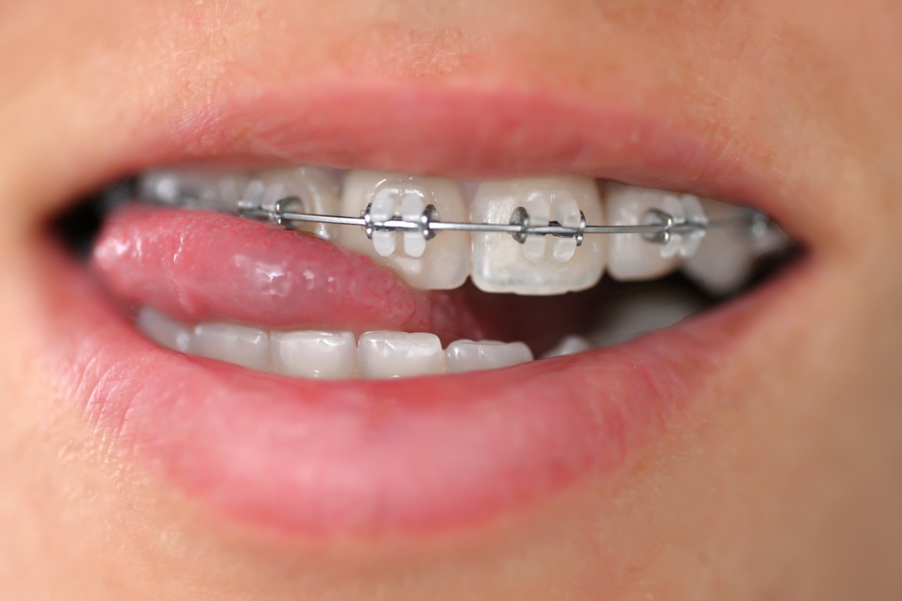 bad-breath-here-are-the-causes-and-how-to-fix-it