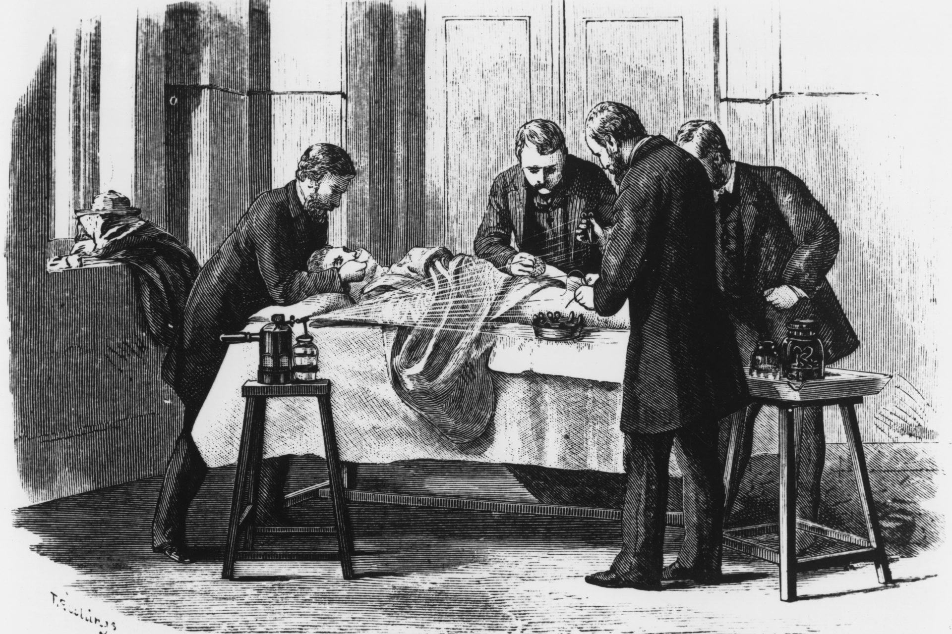 手は洗わずに拭くだけだった