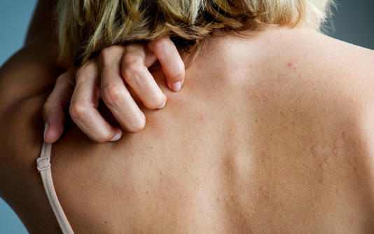 The medical term for a skin itch is 'generalised pruritus' - Getty