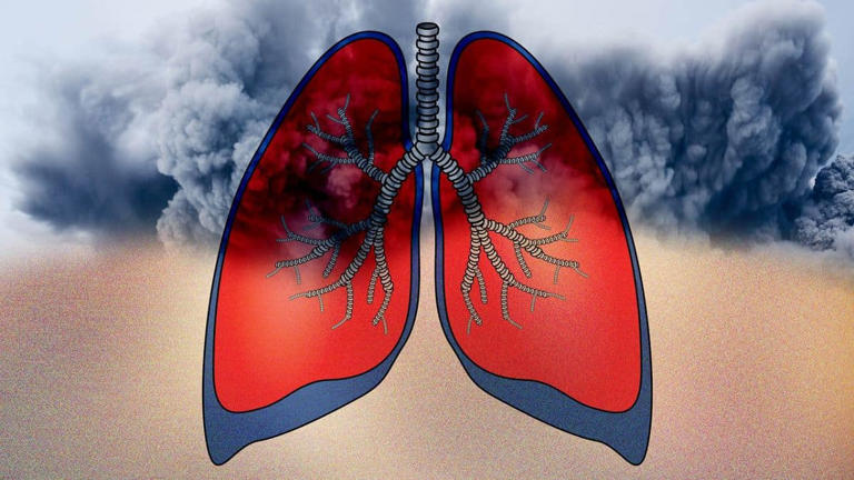 Breathing easier! How to minimise the impact of air pollution on lung ...