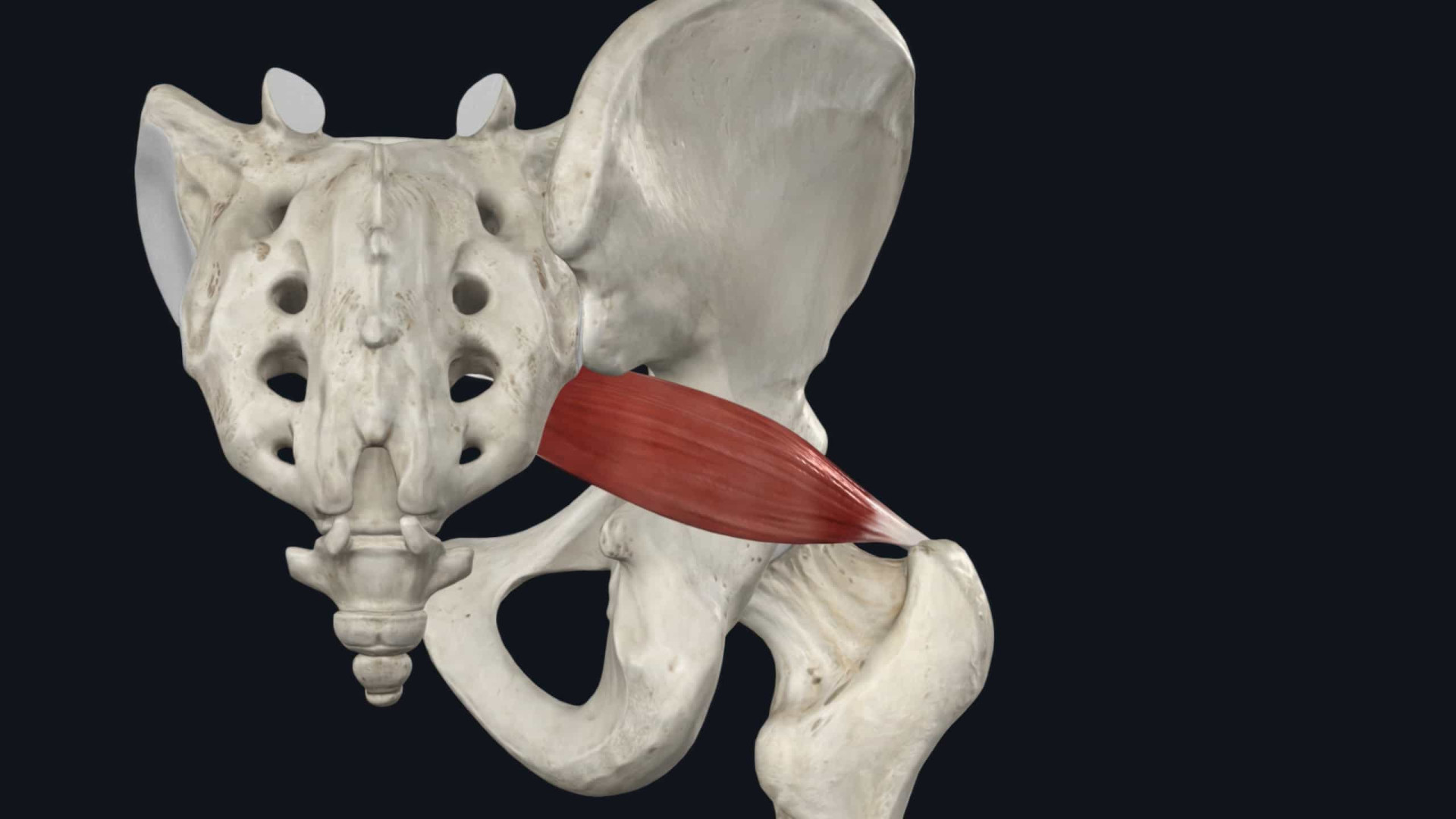 Piriformis syndrome: why it feels like sciatica