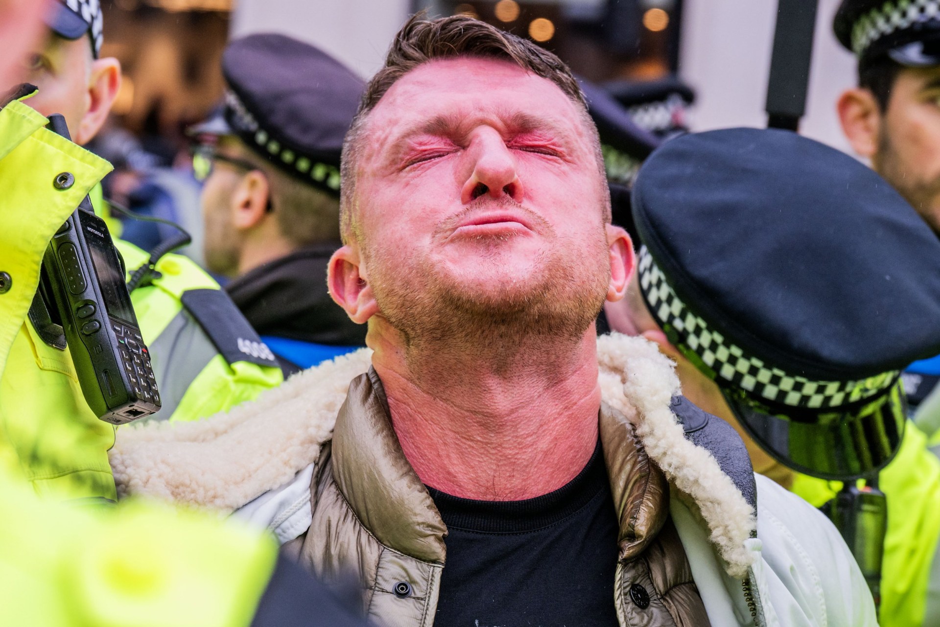 tommy robinson's face is a picture after he's pepper sprayed at antisemitism rally