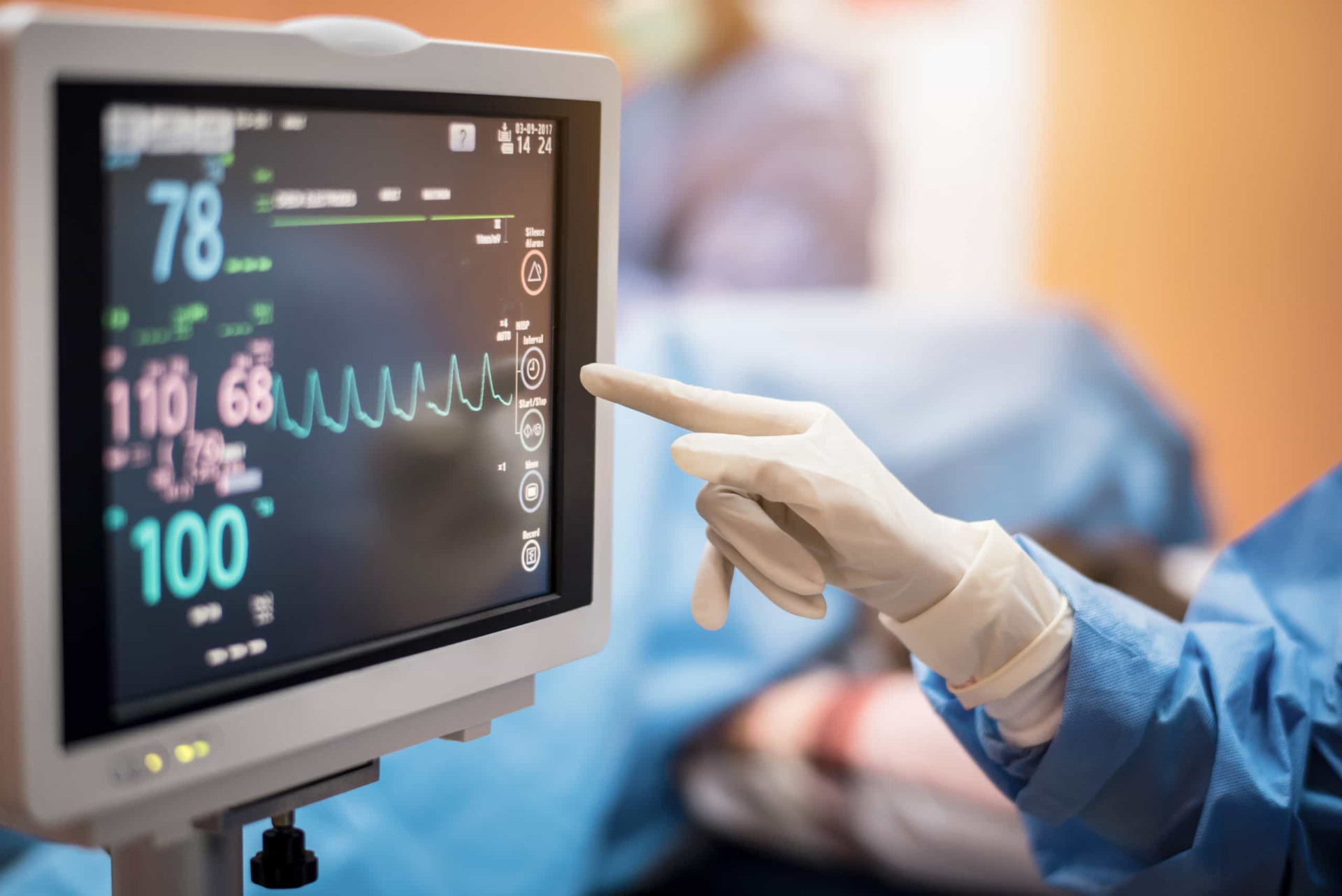 What exactly is atrial fibrillation, and who are its celebrity sufferers?