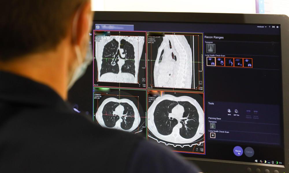 thousands dying needlessly from cancer in uk, report says