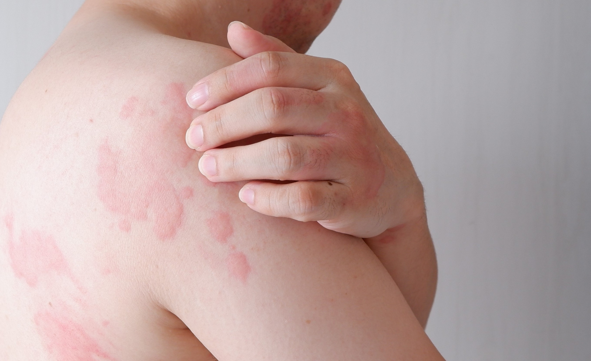 Do you really know how antibiotics work 