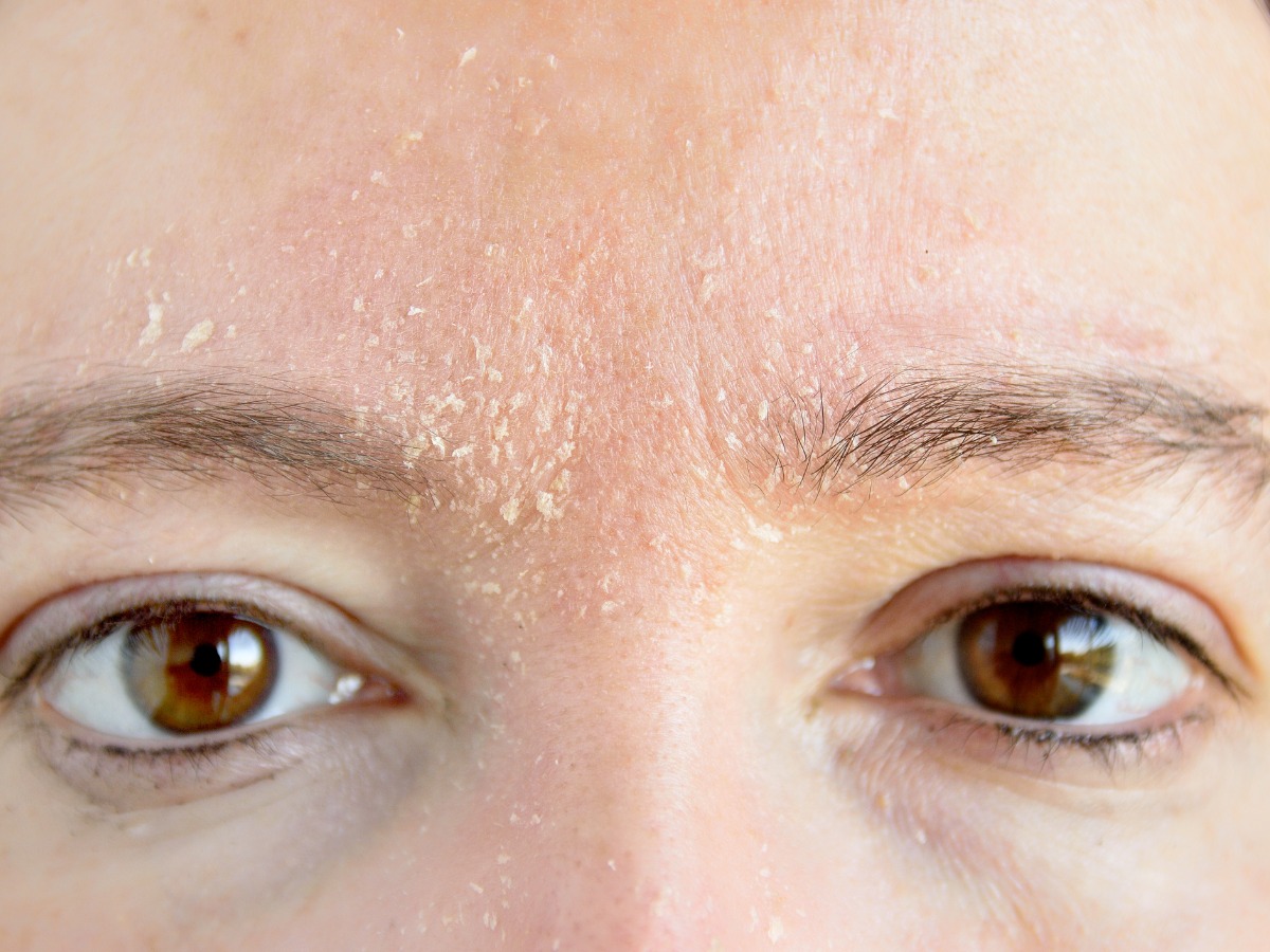 5 tips para sabes si tu tipo de piel es seca o solo está deshidratada