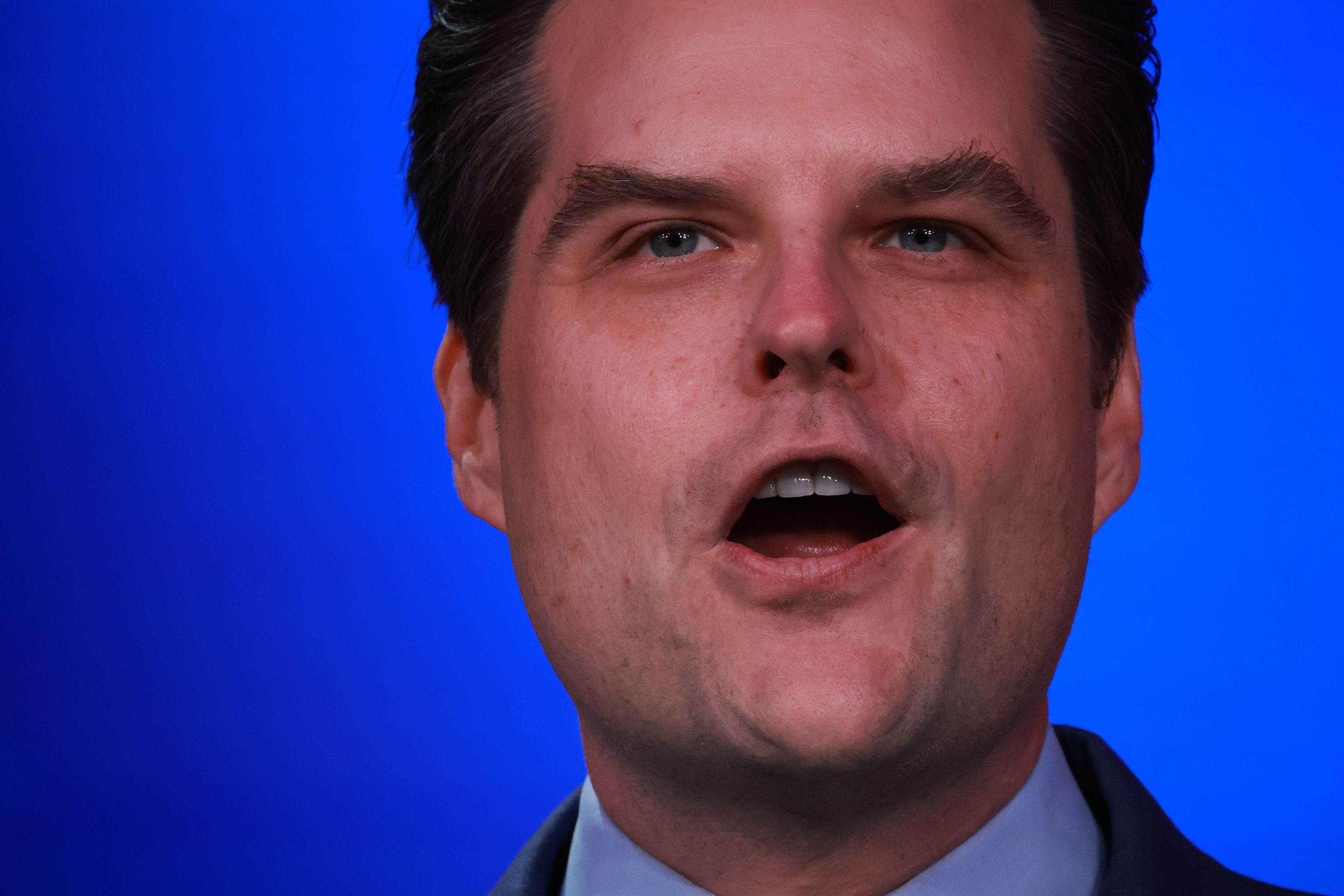 Matt Gaetz Faces a Revolt in His Hometown