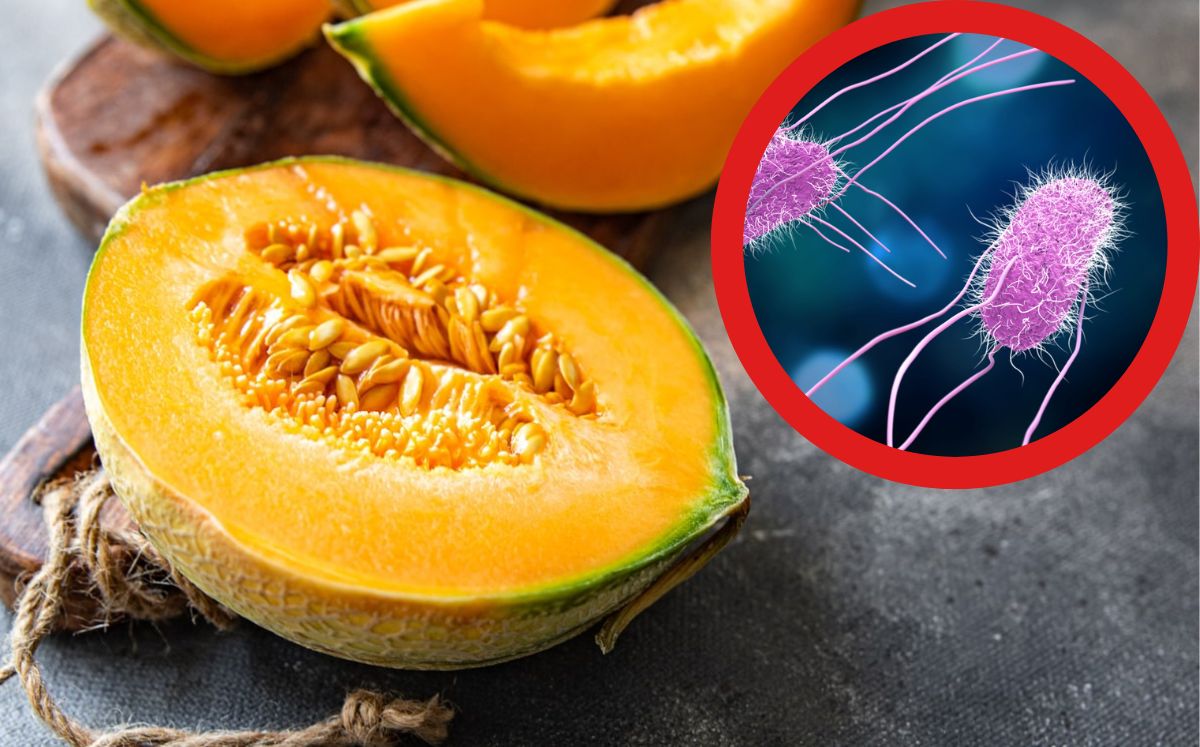 reportan brote de salmonela en melones ya hay 17 hospitalizados, ¿qué tan peligroso es?