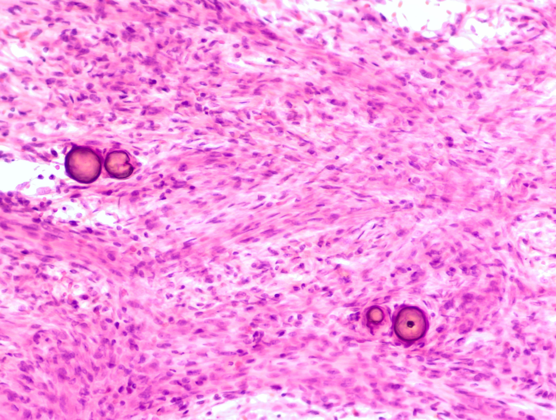 The destructive effects of brain cancer