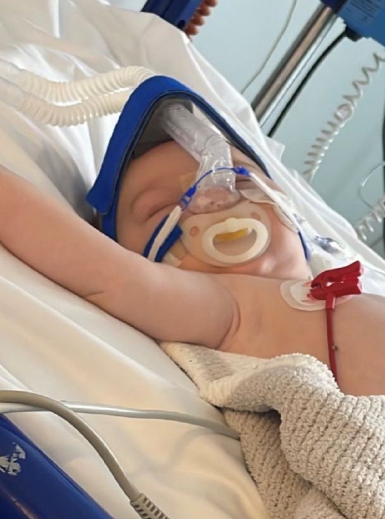 ‘my baby nearly died’ warns mum as cases of rsv virus surge
