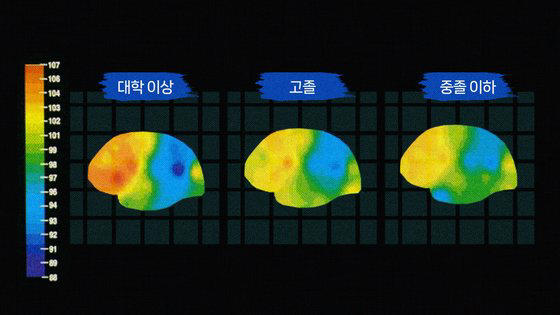 학력이 높으면 뇌에 병리 현상이 많이 나타나도 치매 증상은 덜 나타난다. [사진 스턴 야코브]