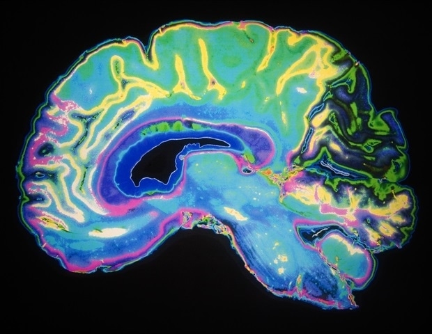new brain connectivity maps offer insights into human consciousness