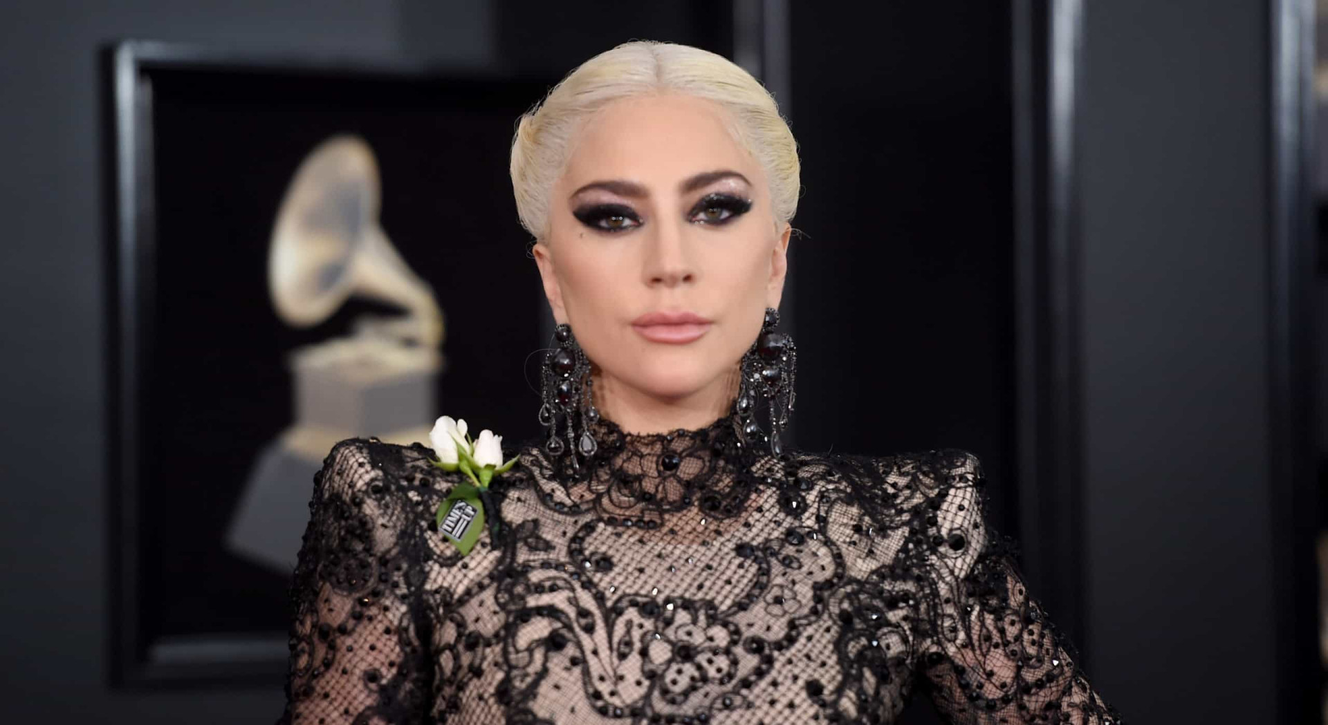 Lupus Understand The Mysterious Disease Affecting Several Celebrities 