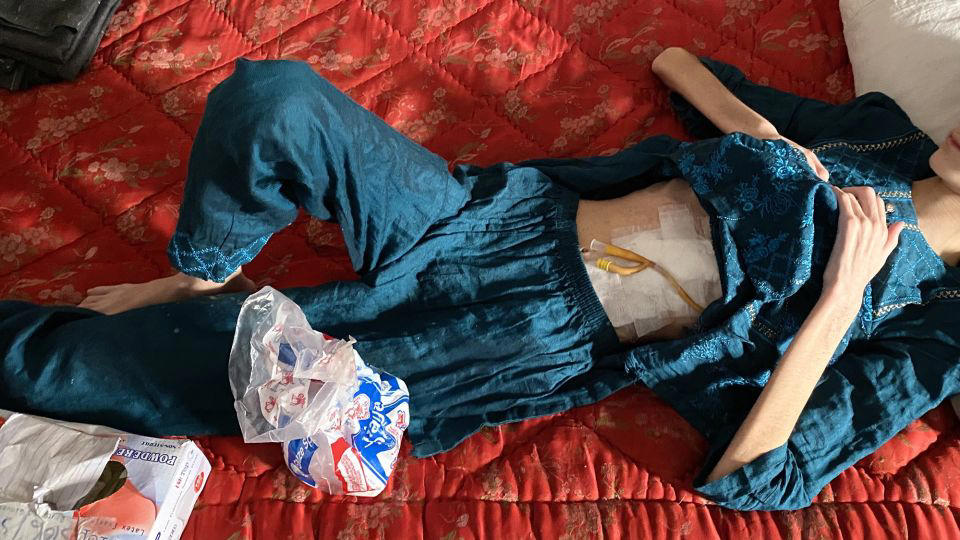 a year ago, she drank battery acid to escape life under the taliban. today, she has a message for other afghan girls
