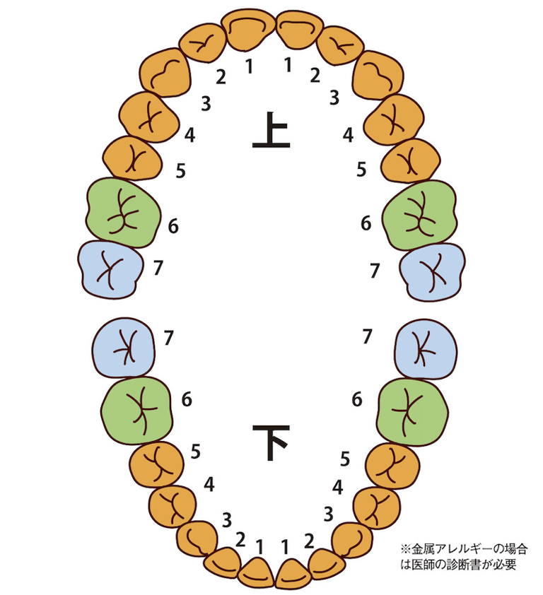 CAD／CAM冠