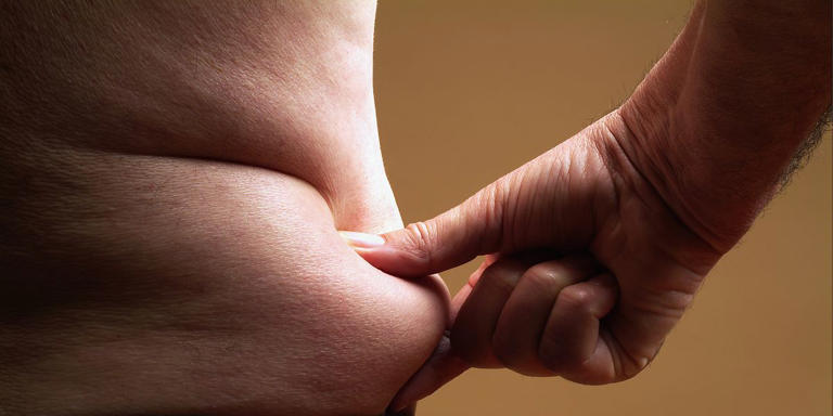Dropping a lot of weight can leave you with loose skin. Doctors explore the most successful ways to tighten it.