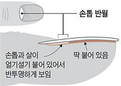 손톱 아래 흰색 반달모양… 안 보이는데 문제 있는 걸까?