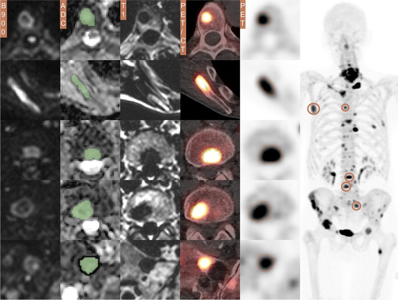 Scientists Now Able To Predict Response To Radium 223 Treatment In   AA1lR8KR.img