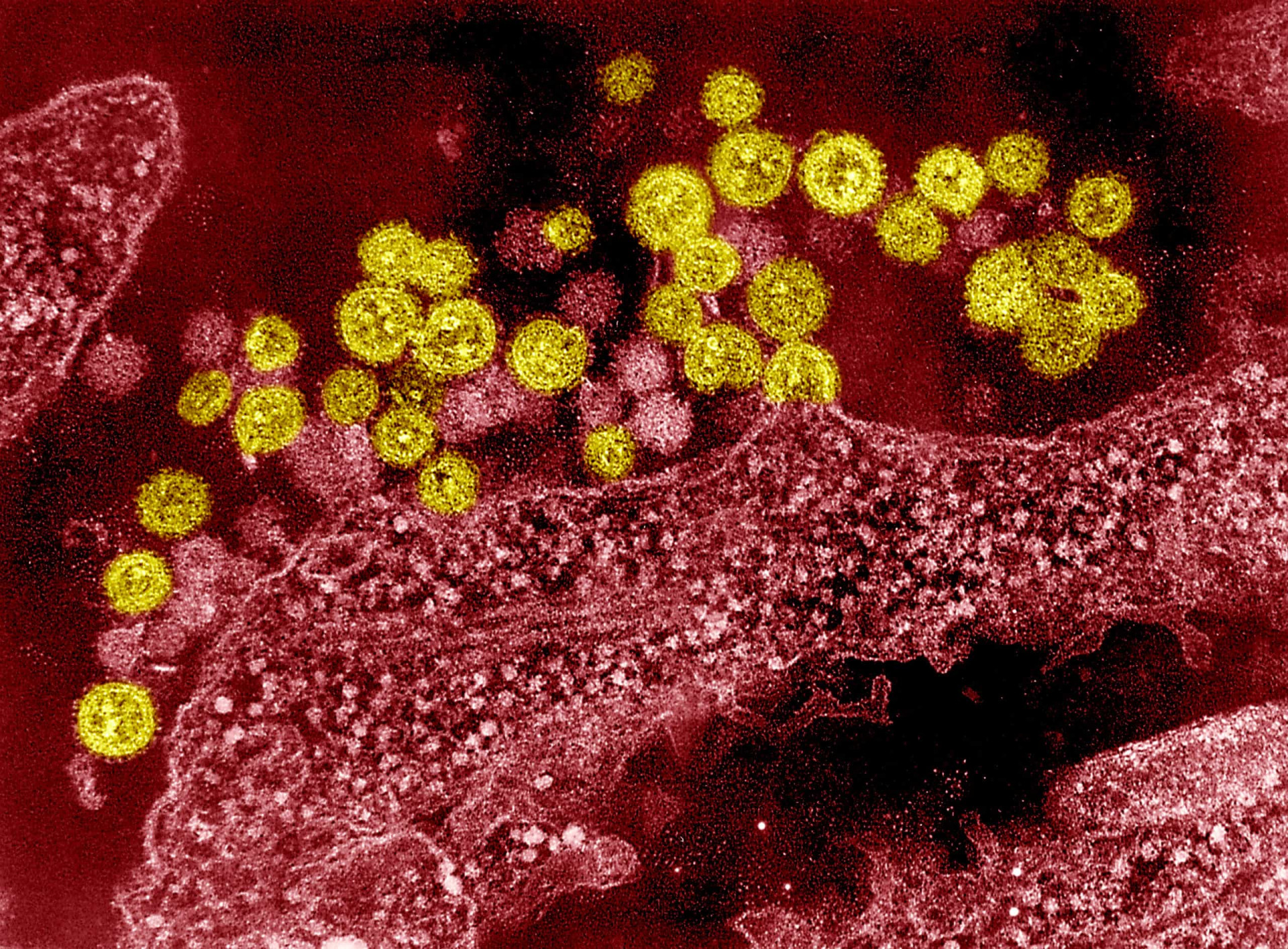 The lethal beauty of viruses and bacteria