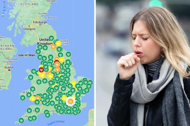 Whooping Cough Cases Mapped As Cases Of The ‘100-day Cough’ Rise Across ...