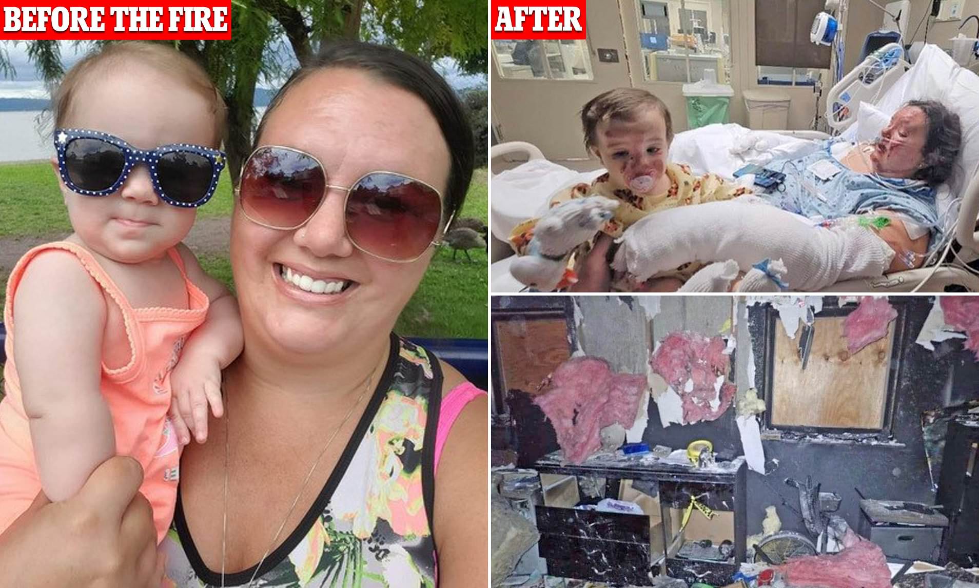 Mother Who Rescued Her Baby From House Fire Is Left With Scars