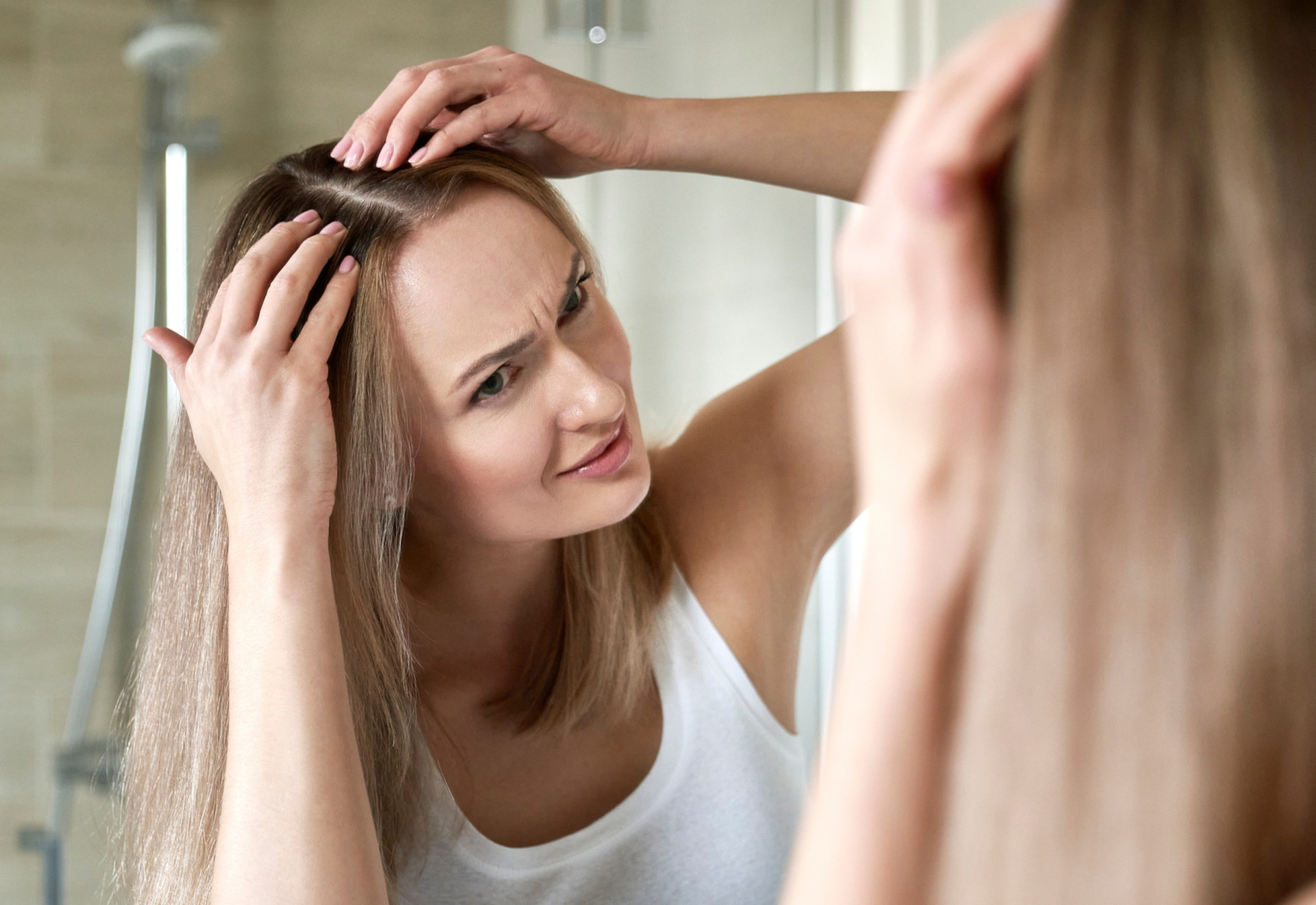 Heres How To Really Deal With Dandruff 0913