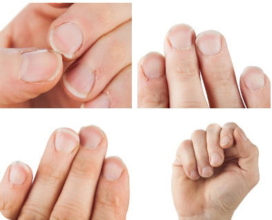 Las 7 señales que pueden dar tus uñas sobre tu estado de salud