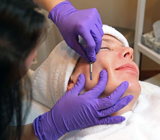 dermatologists explain the pros and cons of dermaplaning