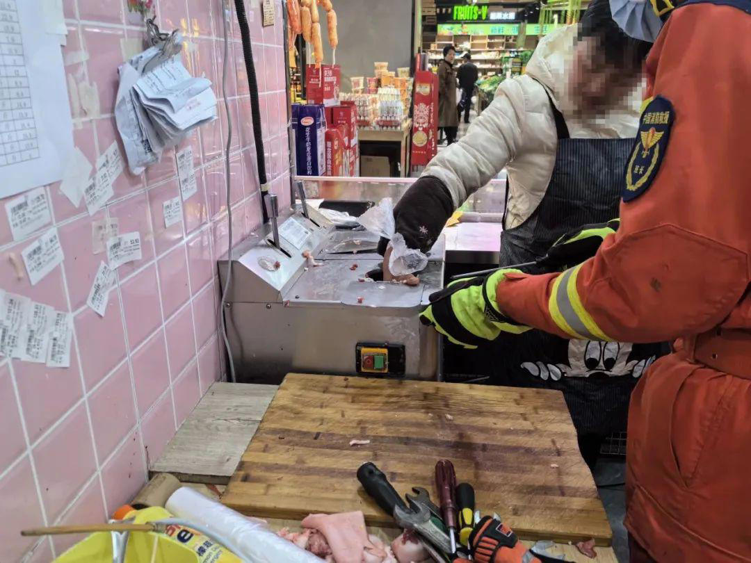 陕西西安：一只被机器意外绞断的手臂寄养其小腿后再回植成功-中国科技网