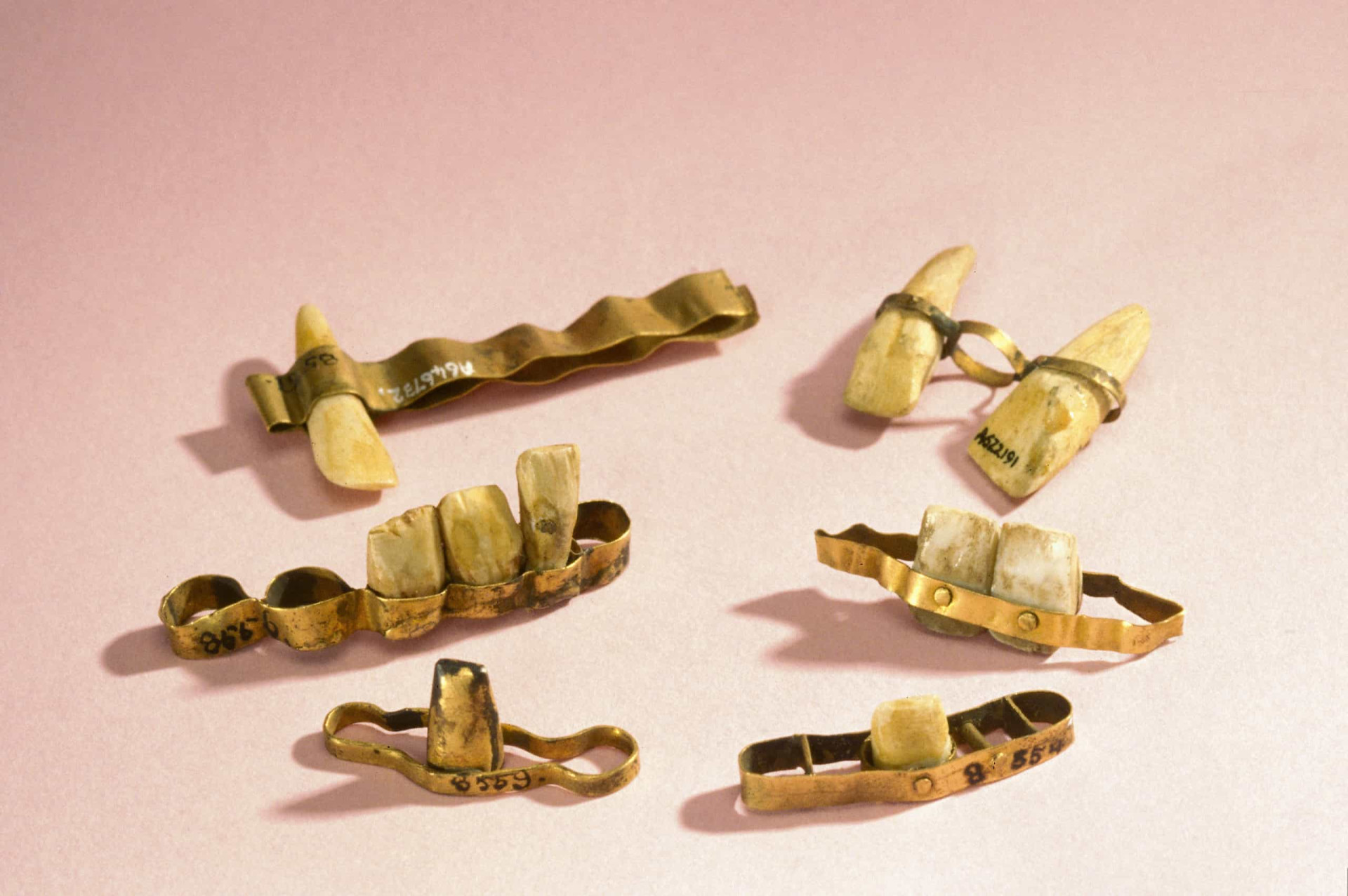 Зубные протезы в древнем Риме. Стоматология в древнем Египте. Древние зубные протезы Этруски. Индеец зуб