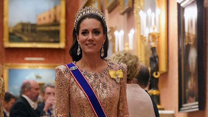 Dirawat Setelah Operasi Perut, Kate Middleton Minta Maaf Tunda Kegiatannya