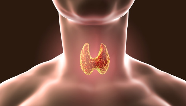 kapan kelenjar tiroid butuh pembedahan? simak penjelasan pakar bedah