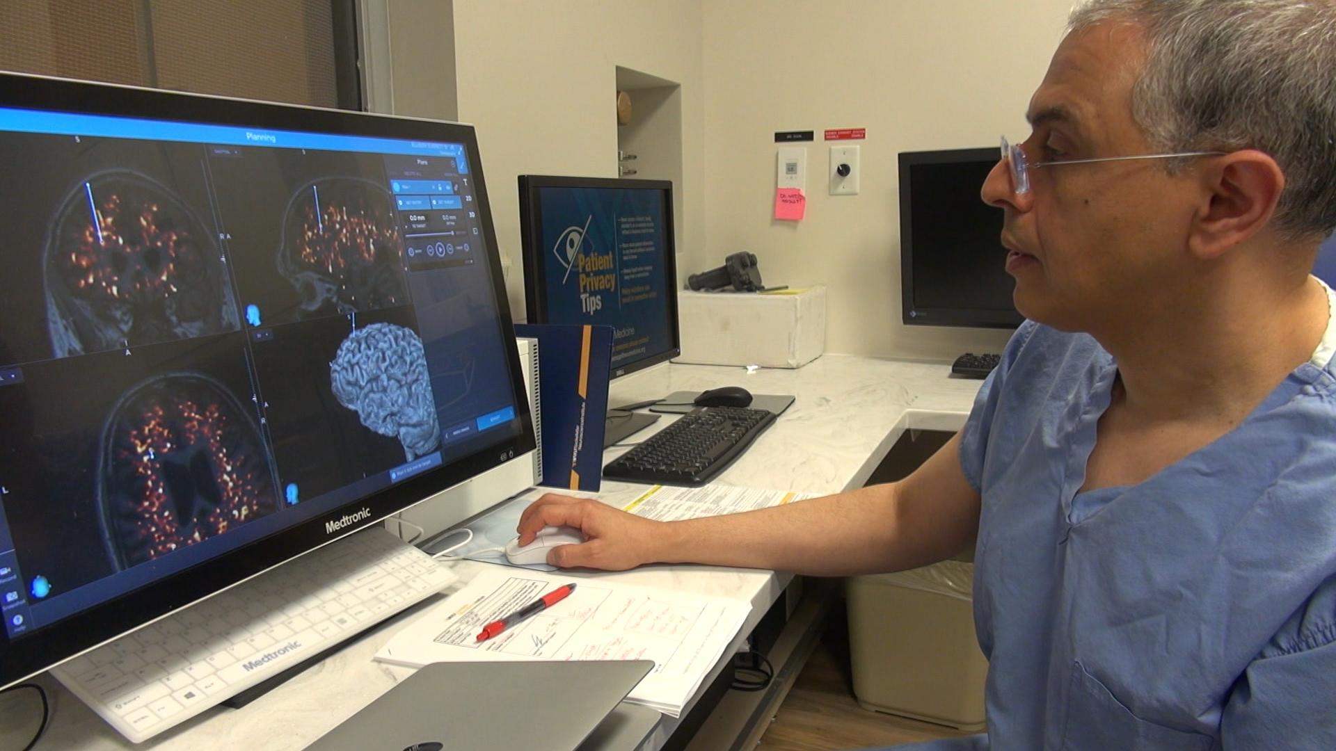 neurosurgeon works to treat alzheimer's, addiction with ultrasound technology