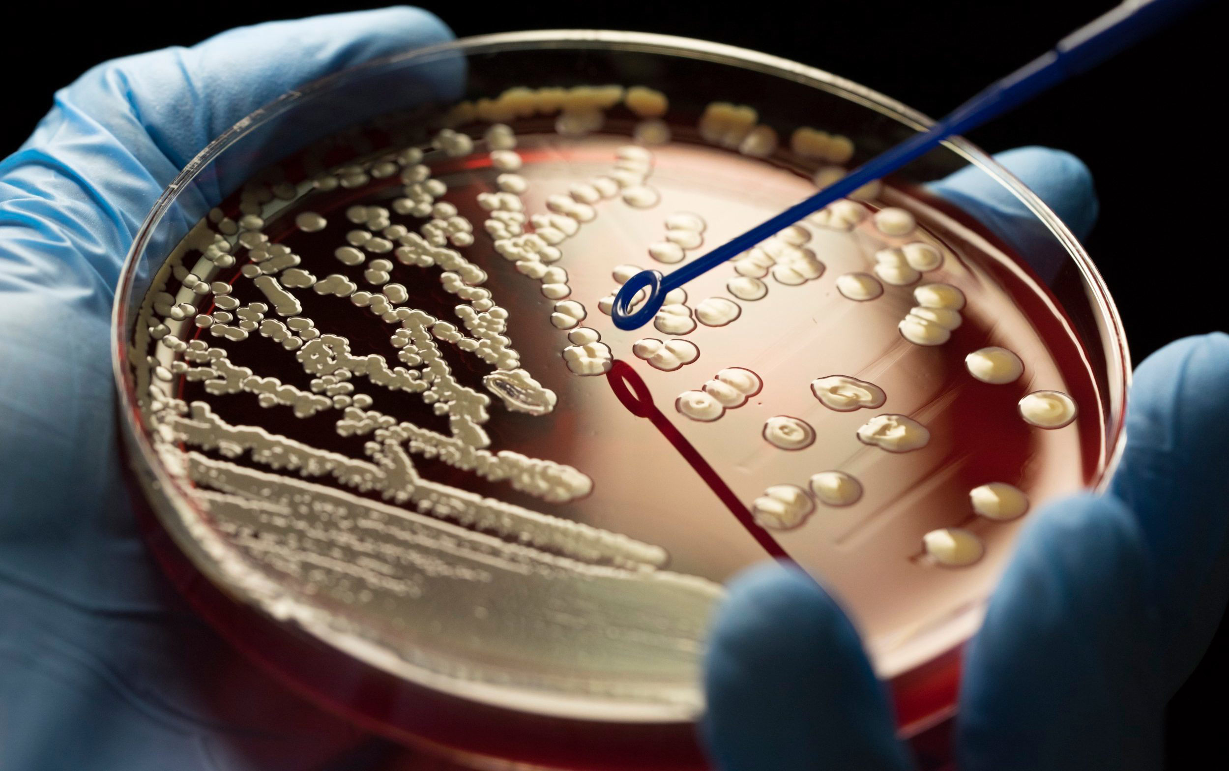New antibiotic appears to kill bacteria that poses key threat to human ...