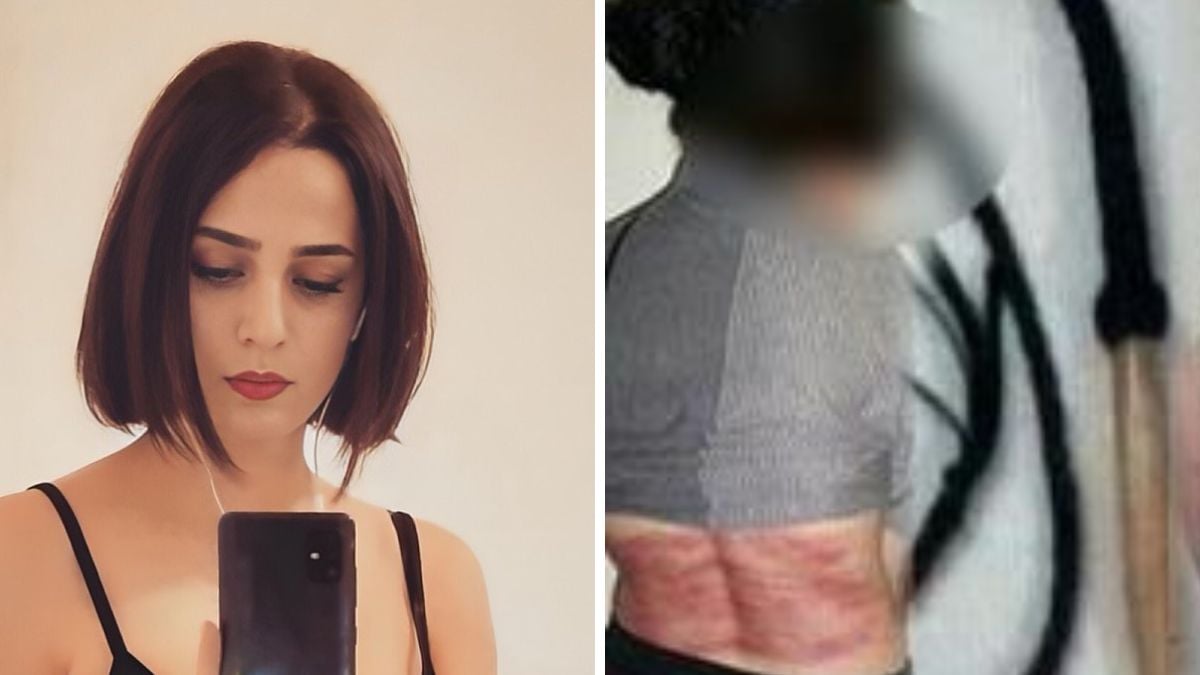 Iranian Woman Punished With 74 Lashes For Refusing To Wear Hijab Shocking Pic Surfaces 