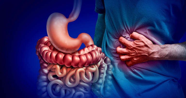 16 sintomas comuns da doença de Crohn para você se atentar