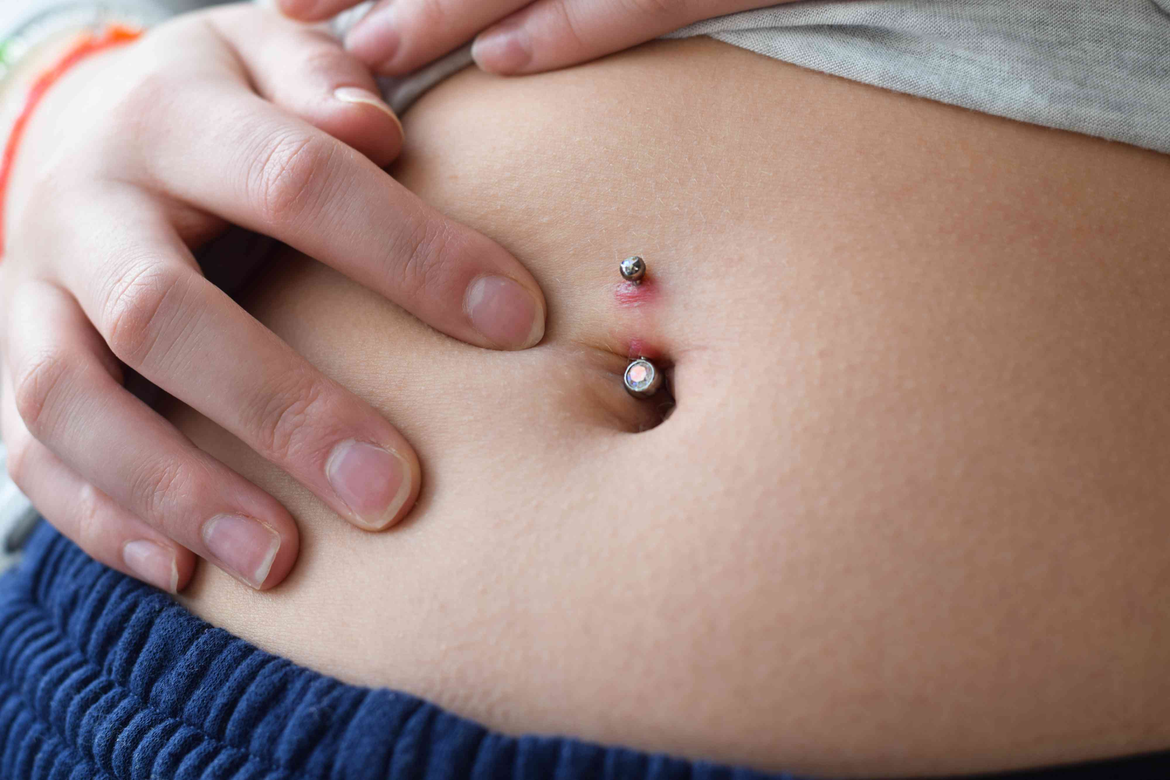 What Does A Healing Belly Piercing Look Like