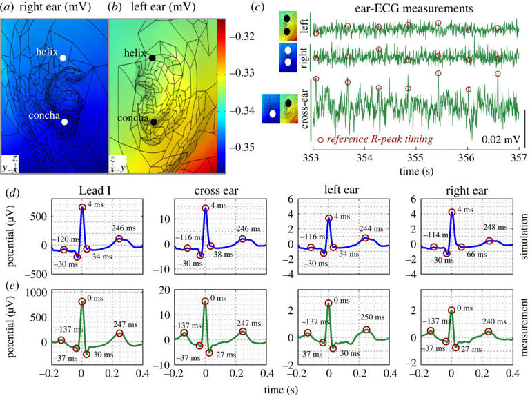 research-shows-how-a-tiny-device-in-the-ear-canal-can-monitor-heart-health