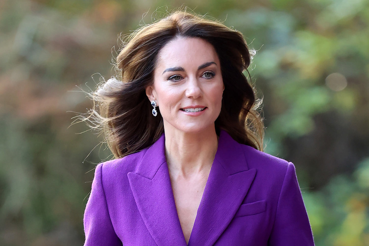 Britain's Princess Kate Is Hospitalized For Up To Two Weeks After ...