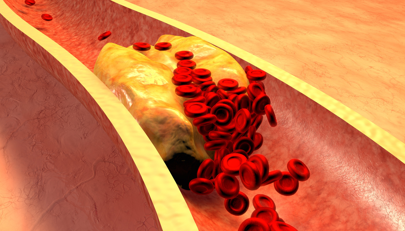 4 formas que te ajudam a reduzir colesterol naturalmente