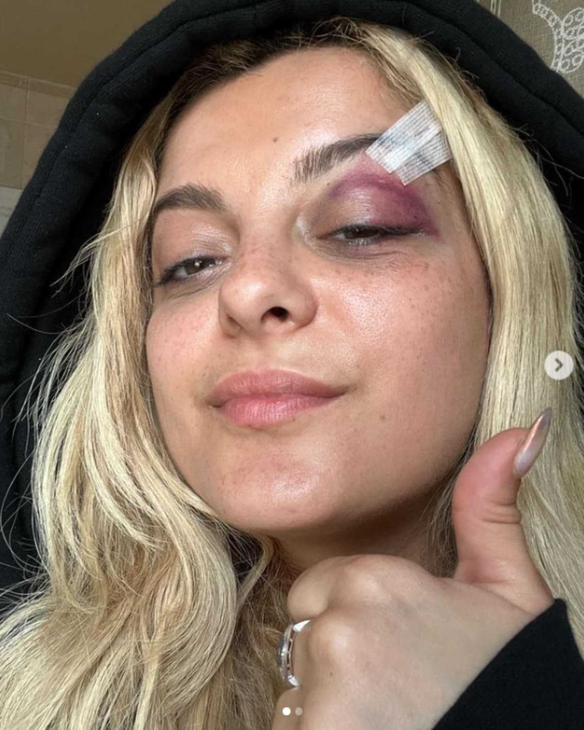 <p>An audience member hurled a cell phone at Bebe Rexha as she was performing at a recent tour stop in New York City. Bebe was seen on camera dropping to her knees and clutching her head during the incident. After the show ended, she was taken to the hospital and had three stitches done.</p>